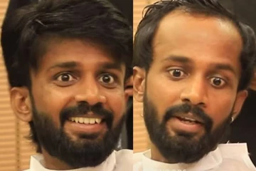 கொட்டிய தலைமுடி!! விக் வைத்து ஆள் அடையாளம் தெரியாமல் மாறிப்போன KPY தீனா..