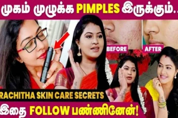 முகம் முழுவதும் Pimples, நான் அதை தான் செய்வேன்- சில அழகு குறிப்புகள் கூறும் சீரியல் நடிகை ரச்சிதா