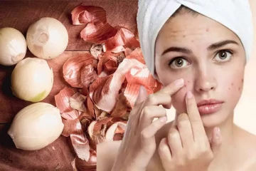 இதைப்படித்த பின் வெங்காயத் தோலை தூக்கி எறிய மாட்டீங்க! நன்மைகள் ஏராளம்