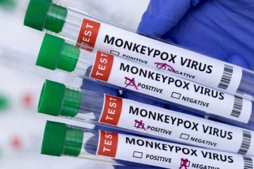 இலங்கையில் மேலும் ஒருவருக்கு குரங்கு அம்மை பாதிப்பு