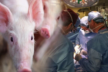 பன்றியின் சிறுநீரகத்தை மனிதனுக்கு பொருத்தி அமெரிக்க மருத்துவர்கள் சாதனை