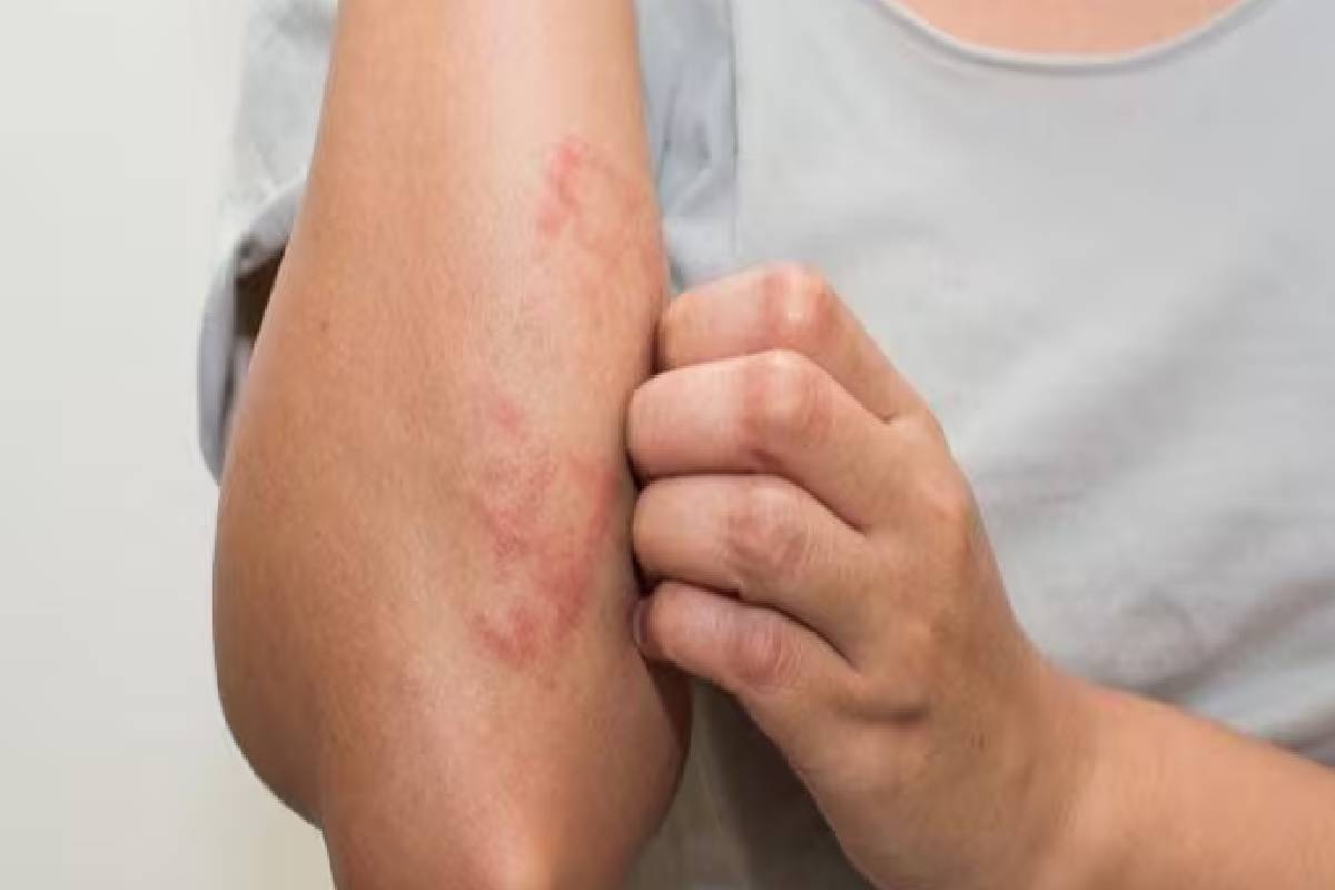 இந்த அறிகுறிகளை புறக்கணிக்காதீர்... புற்றுநோயாக கூட இருக்கலாம் | Cancer Symptoms In Tamil