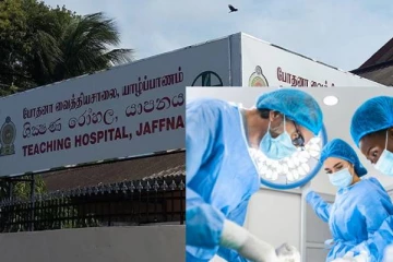 யாழ்ப்பாண போதனா வைத்தியசாலையில் வெற்றிகரமாக நடந்த சத்திர சிகிச்சை!