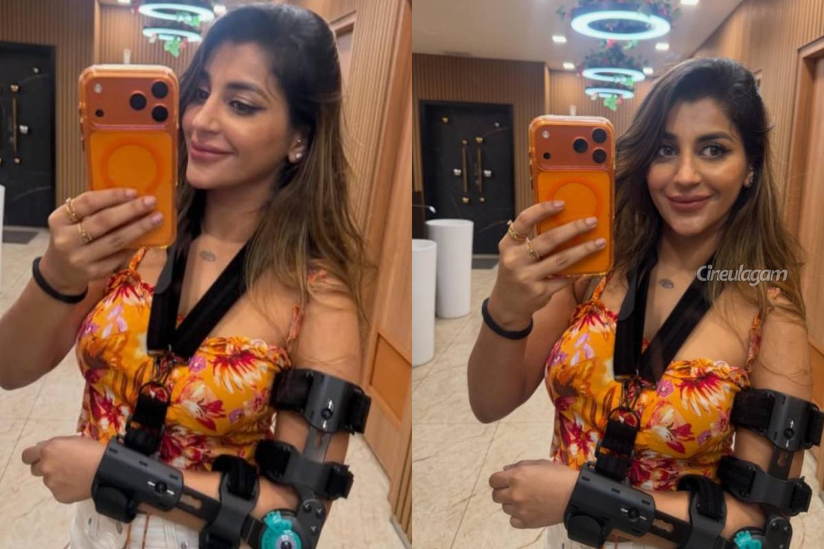 கையில் எலும்பு முறிவு ஏற்பட்டு நடிகை யாஷிகா ஆனந்தின் தற்போதைய நிலை... புகைப்படத்துடன் இதோ | Yashika Anand Fractured Her Hand Photos Viral
