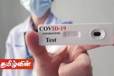 திருமலையில் மேலும் தனியார் வங்கி ஊழியரொருவருக்கு கொரோனா