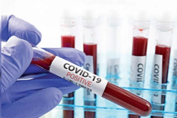 யாழில் 30 பேர் உட்பட வடக்கில் மேலும் 43 பேருக்கு கோவிட் தொற்று