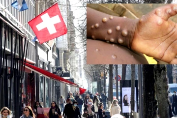 சுவிட்சர்லாந்தில் முதல் குரங்கம்மை தொற்று பாதிப்பு உறுதி!