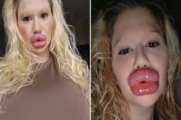 ஒரே நாளில் 6 அறுவை சிகிச்சை... திருமணம் செய்ய முடியாமல் தவிக்கும் பெண்!