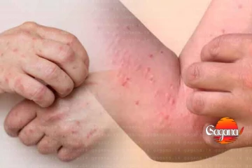 තවත් දරුණු රෝග දෙකක වැඩිවීමක් - දරුණු අනතුරු ඇඟවීමක්