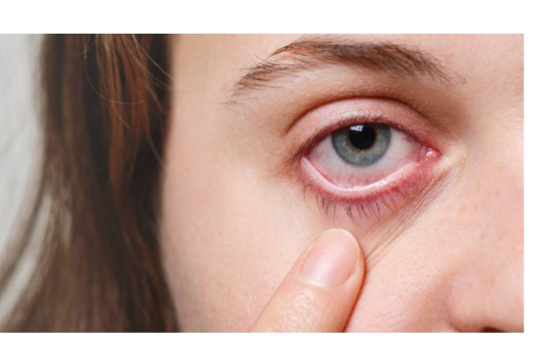 கருப்பு பூஞ்சை நோய் எதனால் ஏற்படுகிறது? அறிகுறியும் தடுக்கும் வழிமுறைகளும்; | Black Fungus Symptoms In Tamil