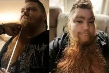 உலகின் நீளமான தாடி கொண்ட பெண்! வேதனையிலும் படைத்த சாதனை