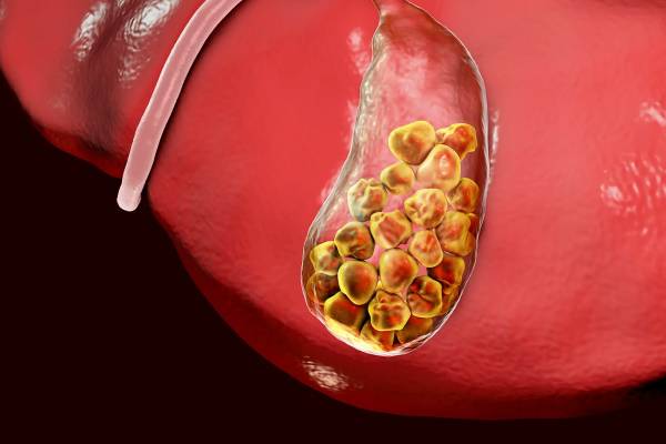 சிறுநீரகத்தில் மட்டுமல்ல இந்த 4 இடத்திலும் கற்கள் உருவாகும் - எங்கு தெரியுமா? | Stones Only In The Kidneys Also In These 4 Places சிறுநீரகத்தில் மட்டுமல்ல இந்த 4 இடத்திலும் கற்கள் உருவாகும் - எங்கு தெரியுமா? | Stones Only In The Kidneys Also In These 4 Places