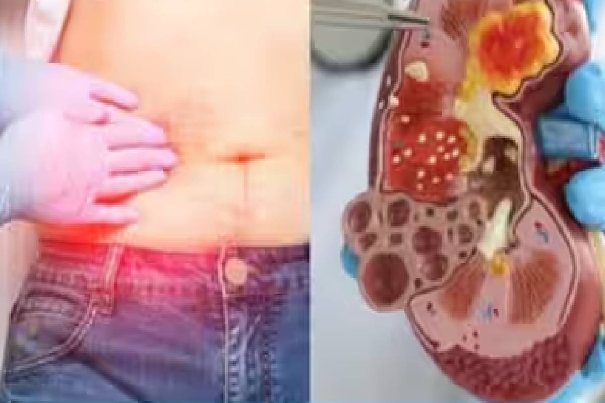 வயிற்றின் எந்த பகுதிகளில் வலி ஏற்படுவது ஆபத்து? இனியும் அலட்சியம் வேண்டாம்! | Stomach Pain Reasons In Tamil