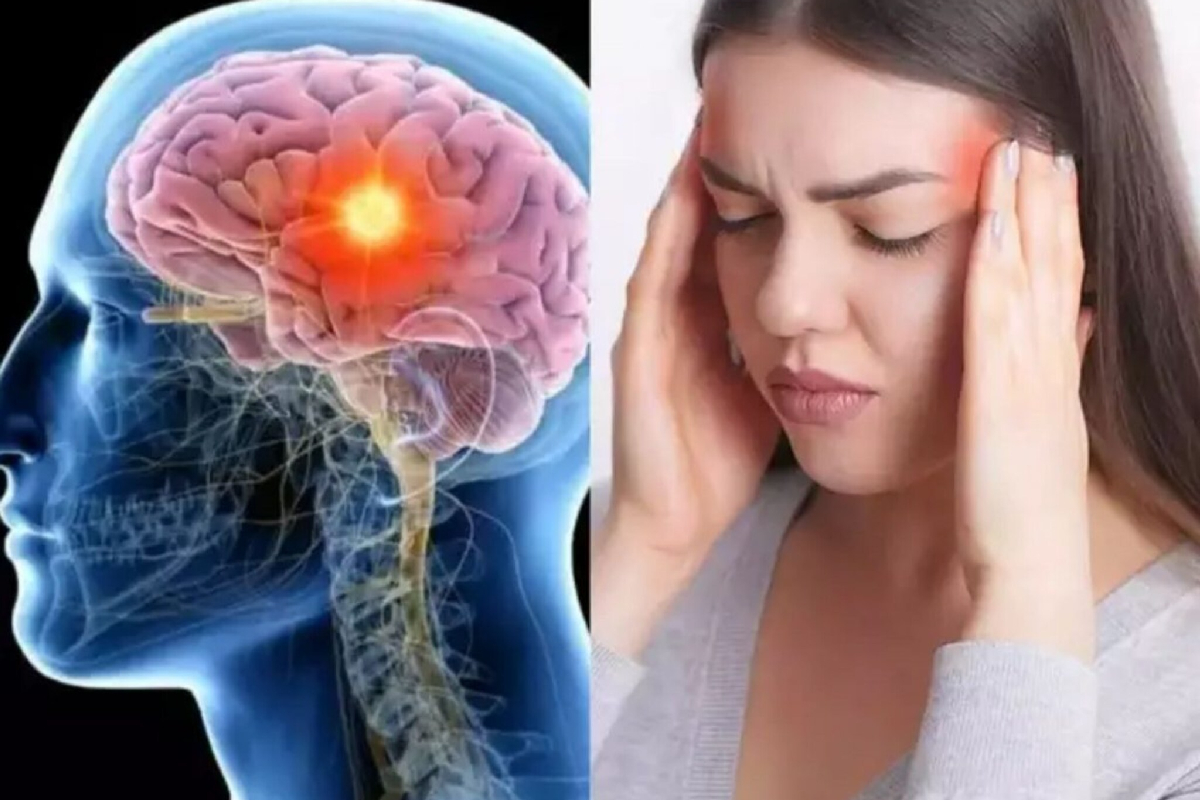 மூளைக்கட்டியின் ஆரம்ப அறிகுறிகள் என்ன? நிபுணர் விளக்கம் | Early Signs Of A Brain Tumor Expert Explanation மூளைக்கட்டியின் ஆரம்ப அறிகுறிகள் என்ன? நிபுணர் விளக்கம் | Early Signs Of A Brain Tumor Expert Explanation