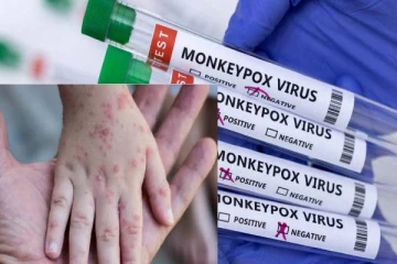 பிரபல நாடொன்றில் உறுதிசெய்யப்பட்டுள்ள குரங்கு காய்ச்சல்!