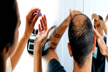 சர்க்கரை வியாதியுள்ளவர்கள் சொட்டையாக தான் இருப்பார்களாம்..! காரணம் என்ன தெரியுமா?