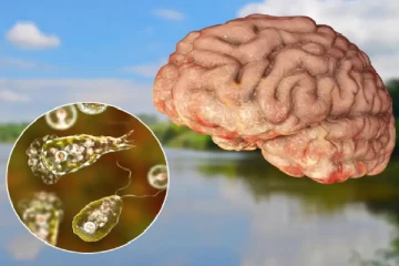 மூளையை தின்னும் கொடூர அமீபா.., அதன் அறிகுறிகள் என்ன?