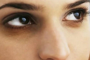 கருவளையத்தை எளிய முறையில் போக்க வேண்டுமா?