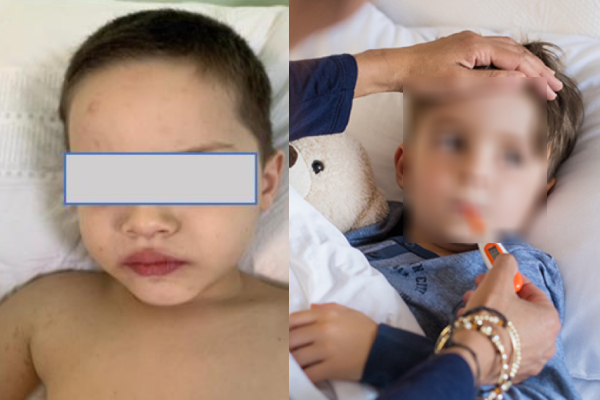 கொரோனா தொற்றுடன் தொடர்புபட்ட 'மிஸ் - சி' : குழந்தைகளுக்கு ஆபத்து - ஐபிசி தமிழ்