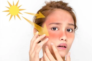 சுட்டெரிக்கும் சூரியனால் களையிழக்கும் முகம்! இதிலிருந்து விடுபட இதோ சூப்பரான டிப்ஸ்