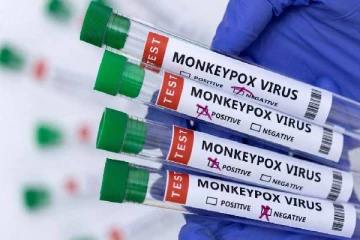 குரங்கம்மையால் இத்தனைப் பேர் பாதிக்கப்பட்டுள்ளனரா?