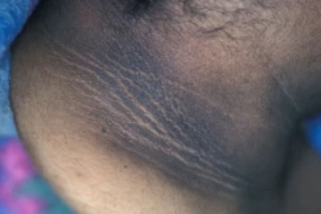 உங்கள் கழுத்து கருமையாக இருக்கா? அதற்கு காரணம் இவைதானாம்!