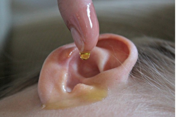 காதில் பட்ஸ் வைத்து சுத்தம் செய்பவரா நீங்கள்? இனி அந்த தவறை செய்திடாதீங்க | Ear Infection Symptoms In Tamil