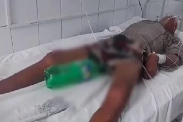 சிறுநீர் பைக்கு பதில் பிளாஸ்டிக் பாட்டில்! மருத்துவமனையில் அவலம்