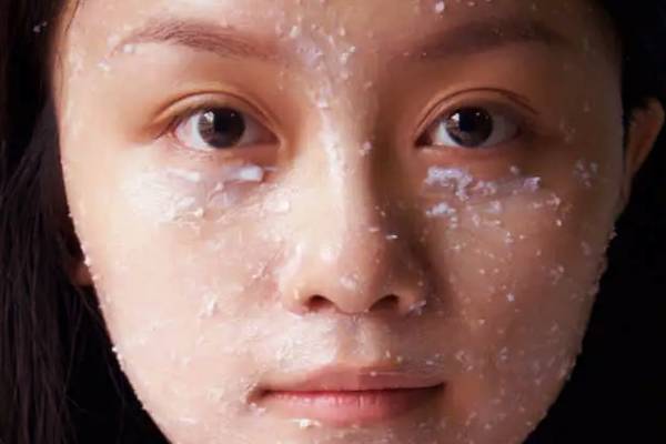 சரும வறட்ச்சிக்கு இன்றே முற்றுப்புள்ளி - இந்த பொருட்கள் போதும் | How To Get Rid Of Dry Skin Health Beauty