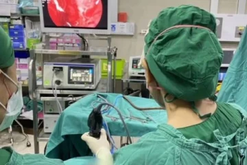 மூக்கடைப்பால் அவதி ; கொத்து கொத்தா குடி இருந்த புழுக்கள் - மிரண்டுபோன மருத்துவர்கள்!