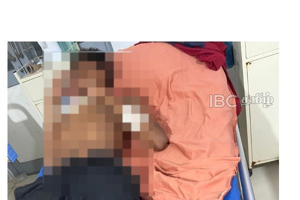 மாணவன் மீது கொடூரமாக தாக்குதல் - தமிழர் பகுதியில் சம்பவம் | Attack Student Vavuniya