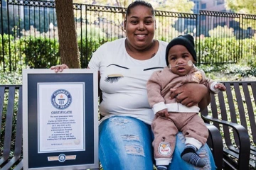 குறை பிரசவத்தில் பிறந்த குழந்தை.... கின்னஸ் சாதனை!