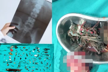 வயிறு வலியென வைத்தியசாலைக்கு சென்றவருக்கு காத்திருந்த அதிர்ச்சி!