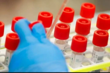 இத்தாலியில் கொரோனா பாதிப்பு 36.50 லட்சத்தை கடந்தது