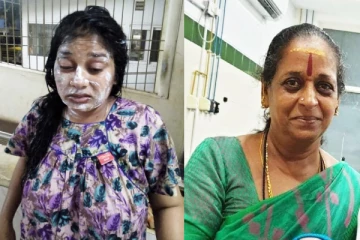 நடத்தையில் சந்தேகம் ; மருமகளின் மீது ஆசிட் வீசிய மாமியார் - கண் பார்வை பறிபோன கொடூரம்..!