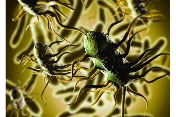 இலங்கையில் Listeria நோயால் பெண்ணொருவர் பலி! | A Woman Died Of Listeria In Sri Lanka