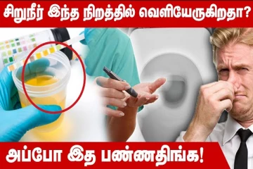 உங்கள் சிறுநீர் இந்த நிறத்தில் தான் வருதா; உடனடியாக வைத்தியரிடம் செல்லுங்க