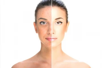 முகத்தில் உள்ள அழுக்குகளை முற்றிலும் நீக்க இவற்றை செய்தாலே போதும்!