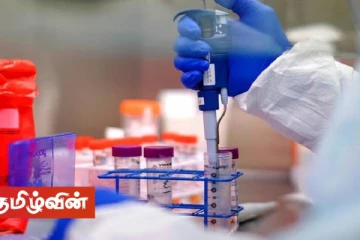 வவுனியா ஆடைத்தொழிற்சாலையில் இதுவரை 21 கோவிட் தொற்றாளர்கள் அடையாளம்