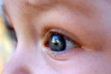 சிறுவர்களுக்கிடையில் பரவிவரும் நோய்த்தொற்று! சுகாதார தரப்பினர் விடுத்துள்ள அறிவுறுத்தல்