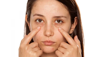 கருவளையங்கள் உங்கள் அழகை பாழாக்குகின்றதா? இதனை போக்க இதோ சில எளிய வழிகள்