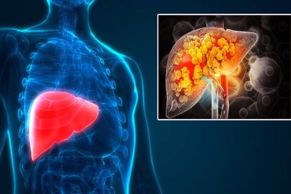 கல்லீரலில் கொழுப்பு கரையணுமா? தினமும் காலையில் இதை சாப்பிடுங்க | Breakfast Foods That Dissolve Fat In The Liver