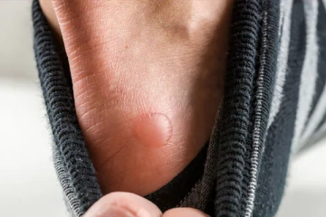 இந்தியாவில் குழந்தைகளைத் தாக்கும் புதிய நோய்! மருத்துவர்கள் எச்சரிக்கை