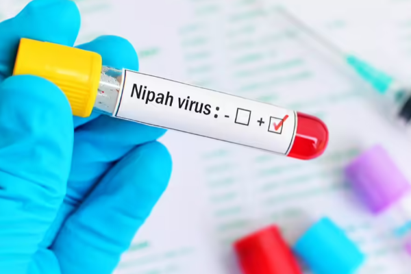 இந்தியாவை அச்சுறுத்தும் நிபா வைரஸ்! விமான நிலையங்களில் கண்காணிப்புப் பணிகள் தீவிரம் | Nipah Virus Outbreak India Surveillance Activities