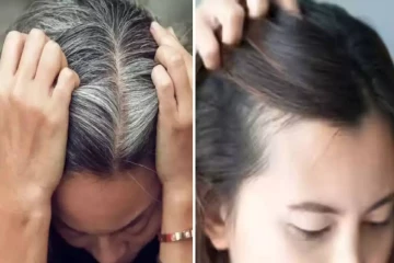 natural home remedies : நரைமுடி பிரச்சினைக்கு இயற்கை தீர்வு! வீட்டிலேயே செய்யக்கூடிய எளிய பராமரிப்புகள்