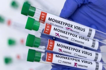 அமெரிக்காவை அதிர்ச்சியில் ஆழ்த்தியுள்ள குரங்கம்மை!