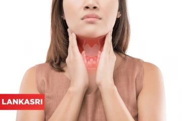 தைராய்டு நோயாளிகளே! மறந்தும் கூட இந்த உணவுகளே சாப்பிட்டாதீங்க.... மோசமான விளைவுகளை ஏற்படுத்துமாம்!