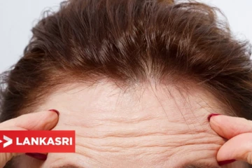 நெற்றிச் சுருக்கத்தை போக்கு எளிய முறையில் போக்க இதோ சில டிப்ஸ்!