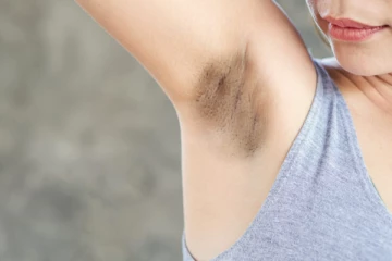 அக்குள் கருமையை போக்கும் வீட்டு வைத்தியம் - என்ன செய்யலாம்?