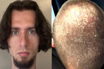 7 வருடம் ஷாம்பூவே யூஸ் பண்ணல.. தலைமுடிக்கு என்னாச்சு தெரியுமா? - இணையத்தில் வைரல்!